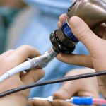 Endoscopy Devices Market