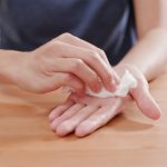 Hyperhidrosis Treatment Market